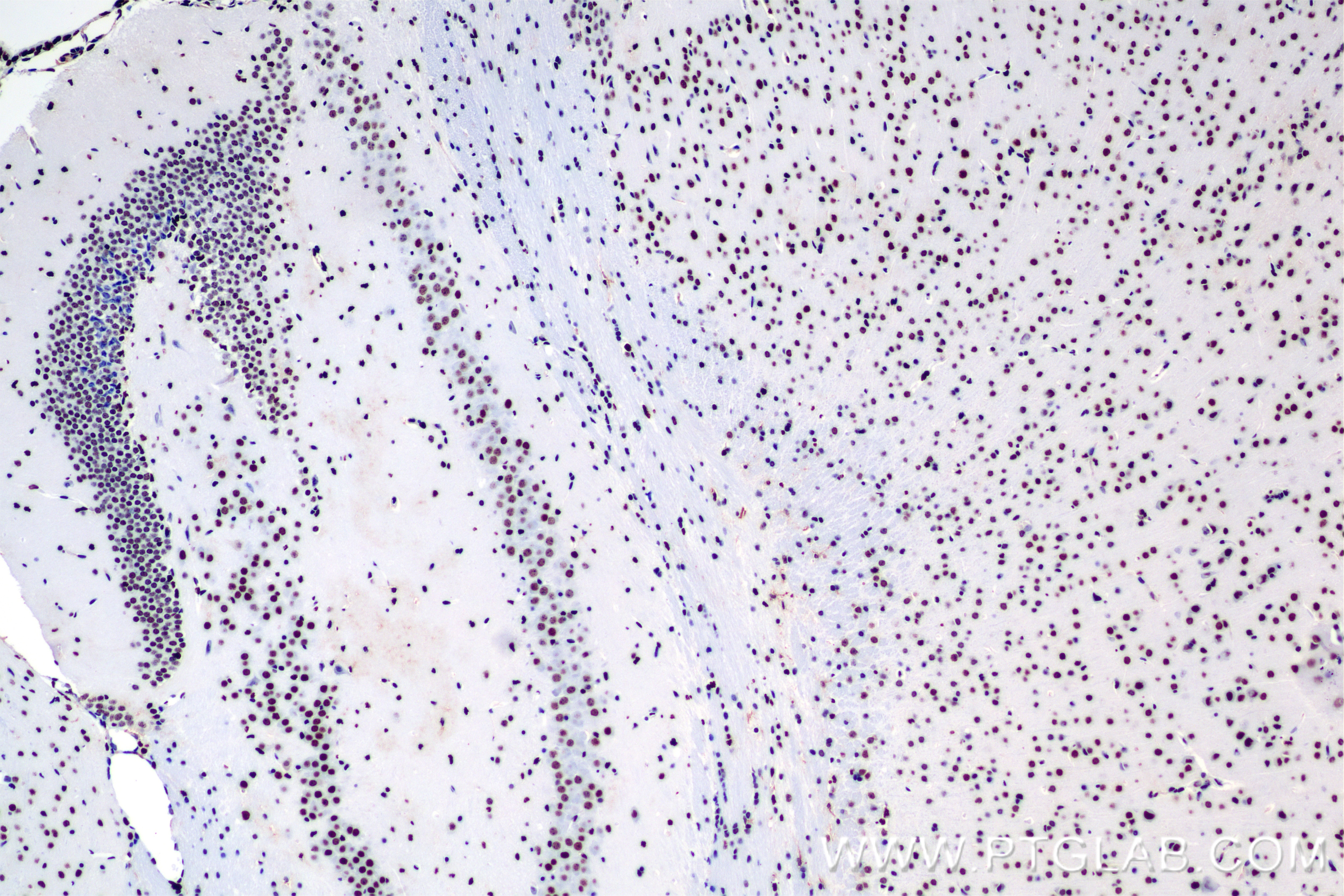 Immunohistochemistry (IHC) staining of mouse brain tissue using GANC Recombinant antibody (84676-3-RR)