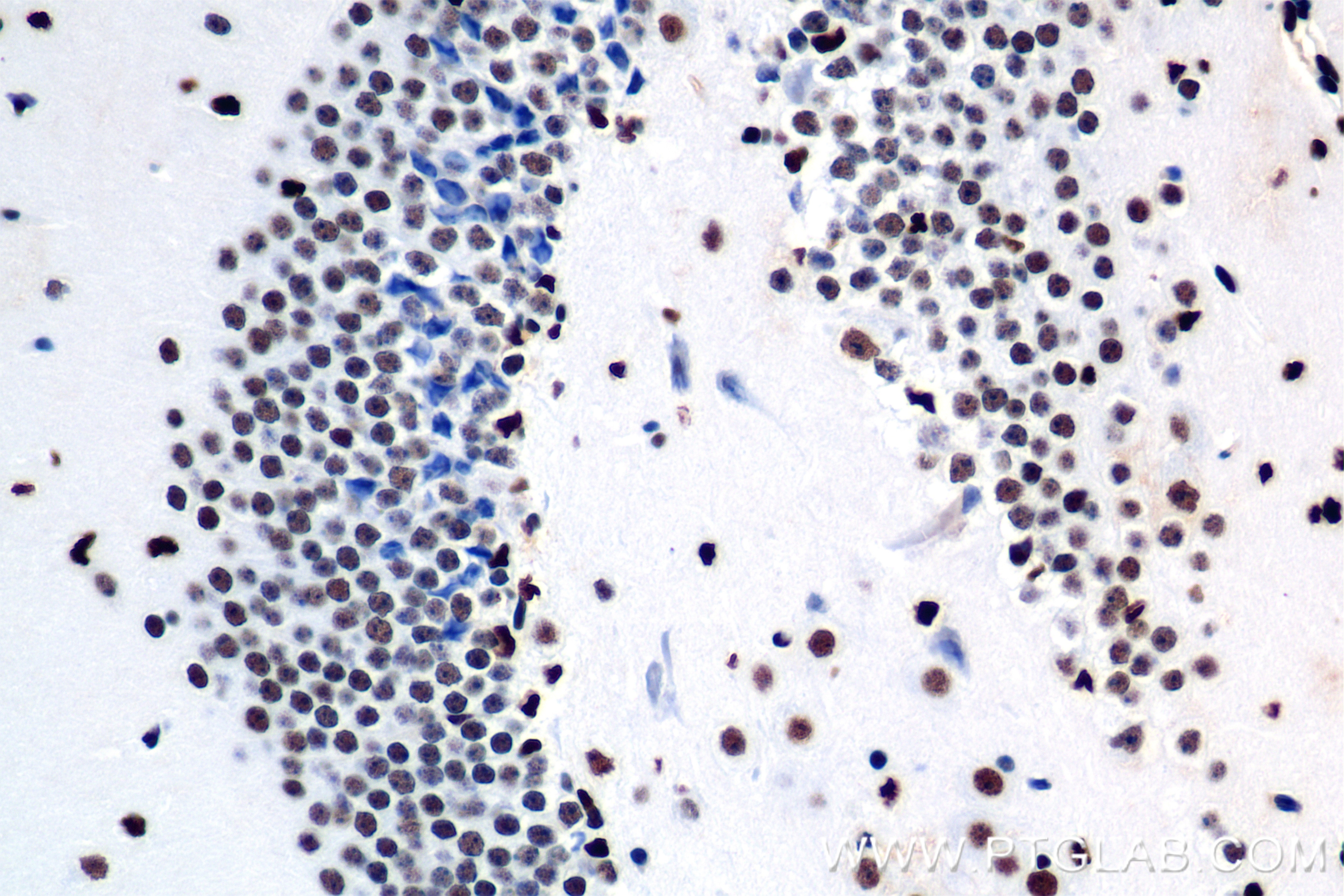 Immunohistochemistry (IHC) staining of mouse brain tissue using GANC Recombinant antibody (84676-3-RR)