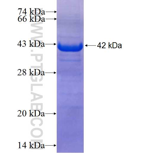 GANC fusion protein Ag24766 SDS-PAGE