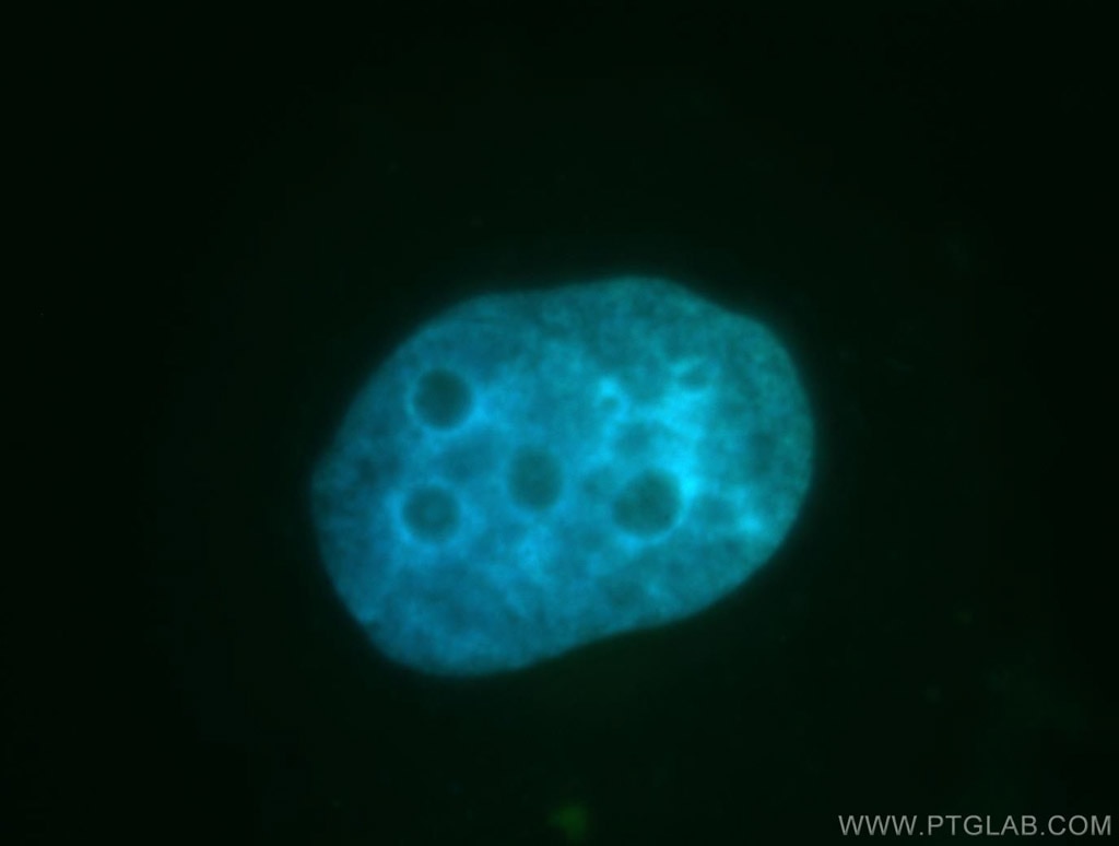 Immunofluorescence (IF) / fluorescent staining of HepG2 cells using GANP Polyclonal antibody (11054-1-AP)