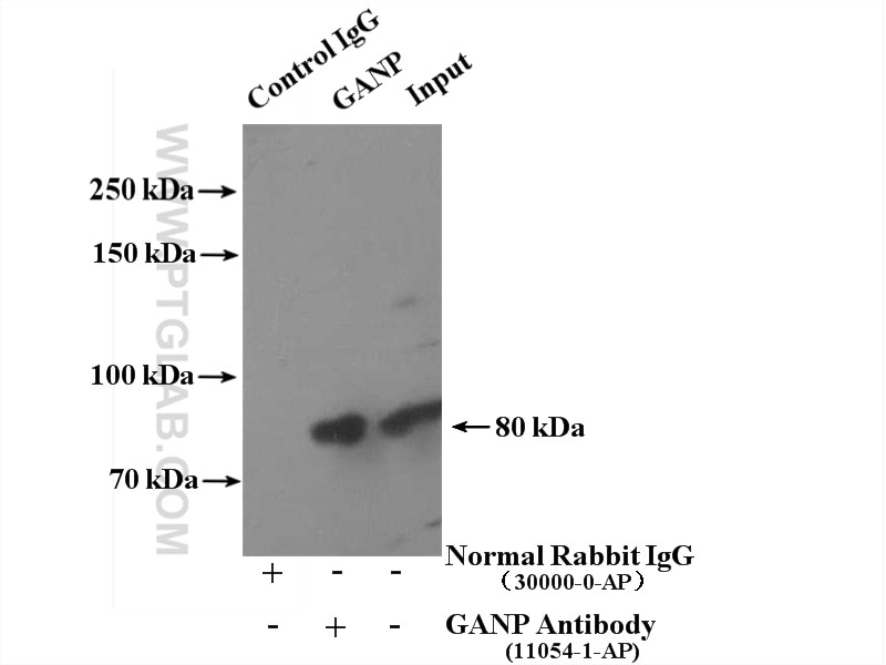 Immunoprecipitation (IP) experiment of mouse brain tissue using GANP Polyclonal antibody (11054-1-AP)