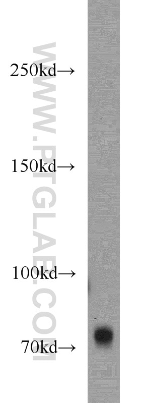 Western Blot (WB) analysis of mouse brain tissue using GANP Polyclonal antibody (11054-1-AP)