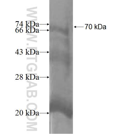 GANP fusion protein Ag1486 SDS-PAGE