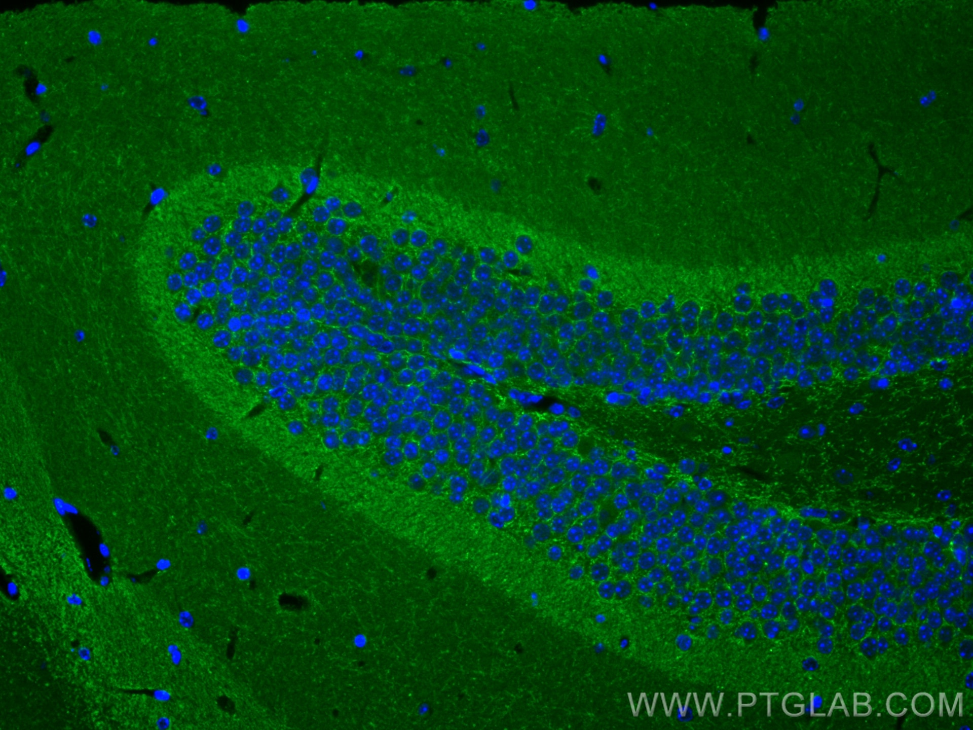 Immunofluorescence (IF) / fluorescent staining of mouse brain tissue using GAP43 Polyclonal antibody (16971-1-AP)