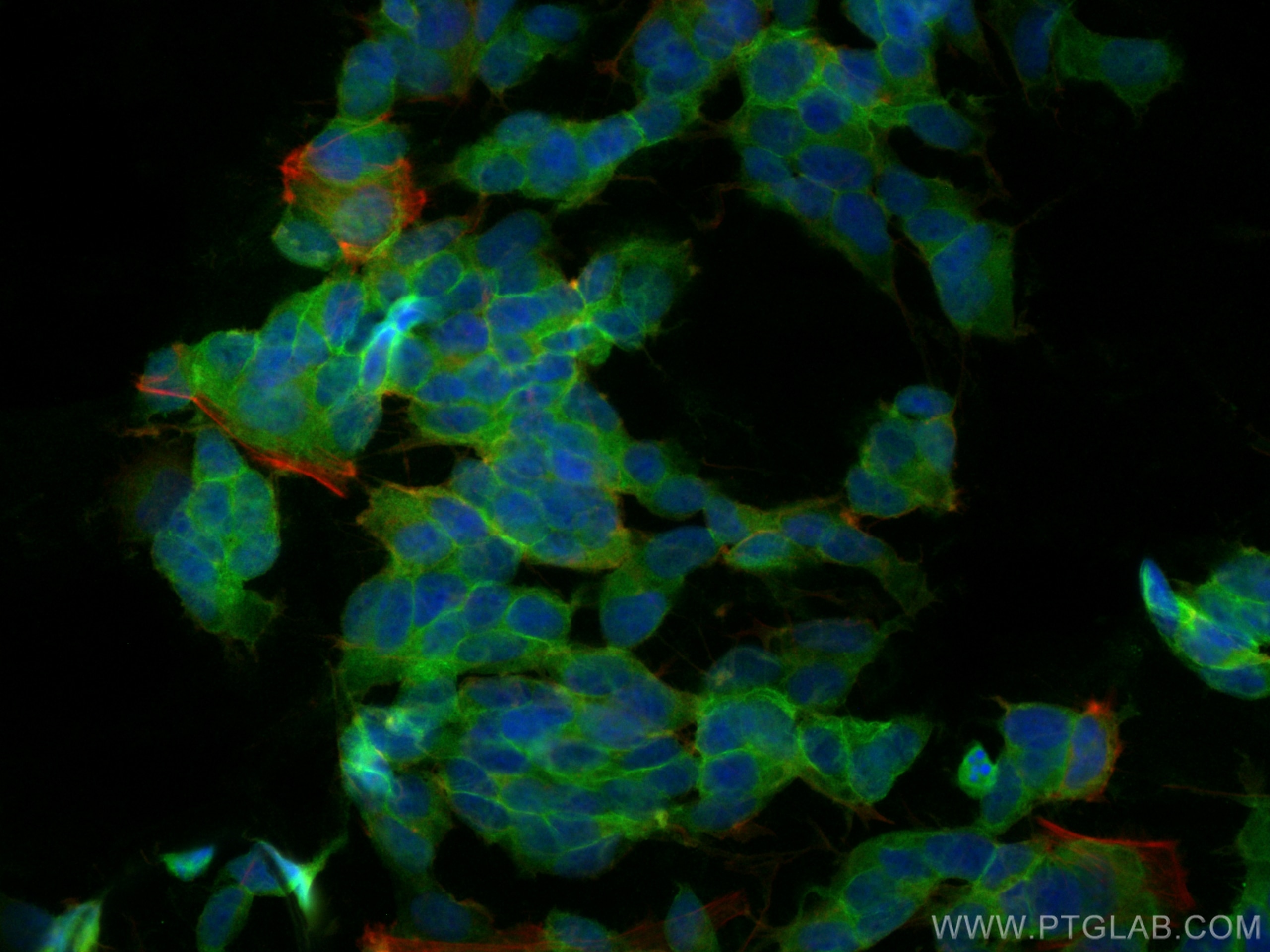 Immunofluorescence (IF) / fluorescent staining of SH-SY5Y cells using GAP43 Polyclonal antibody (16971-1-AP)