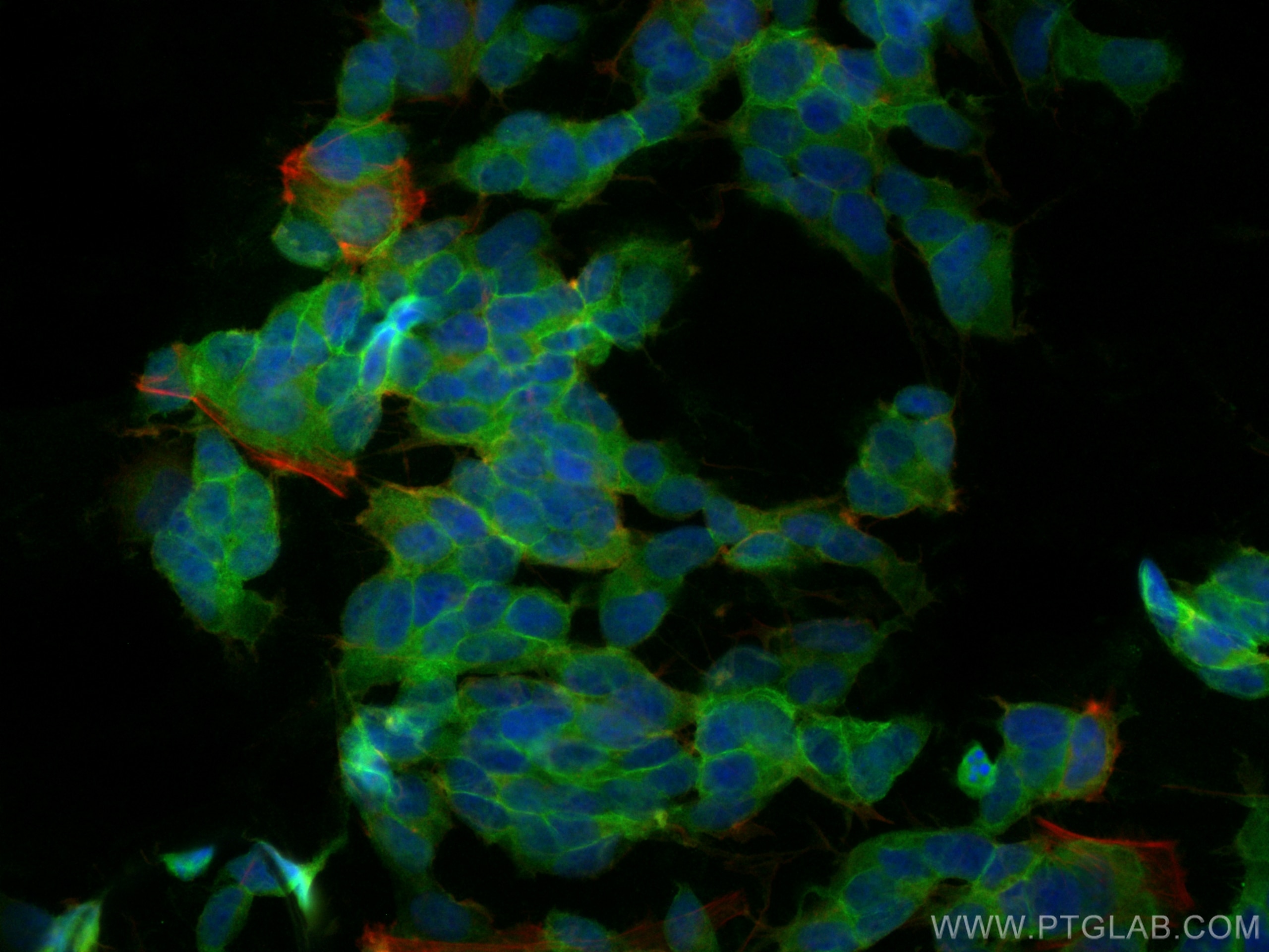 IF Staining of SH-SY5Y using 16971-1-AP