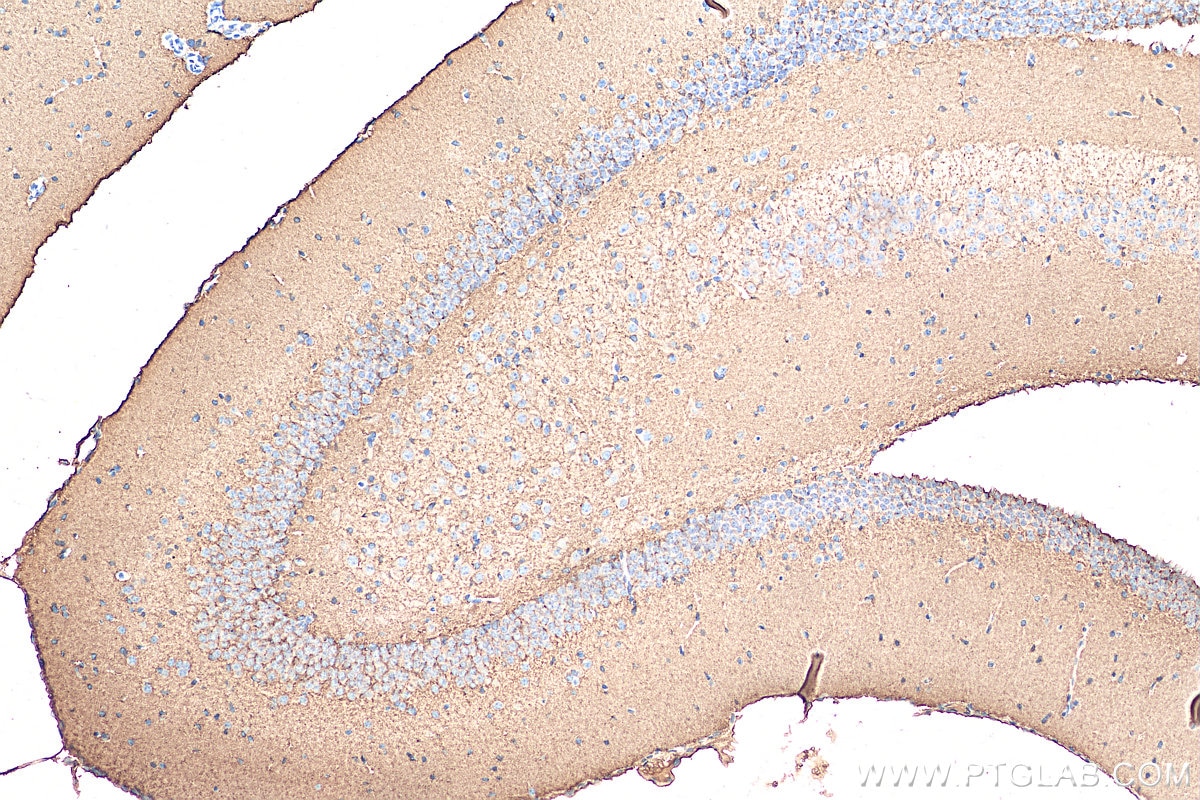 IHC staining of mouse brain using 16971-1-AP