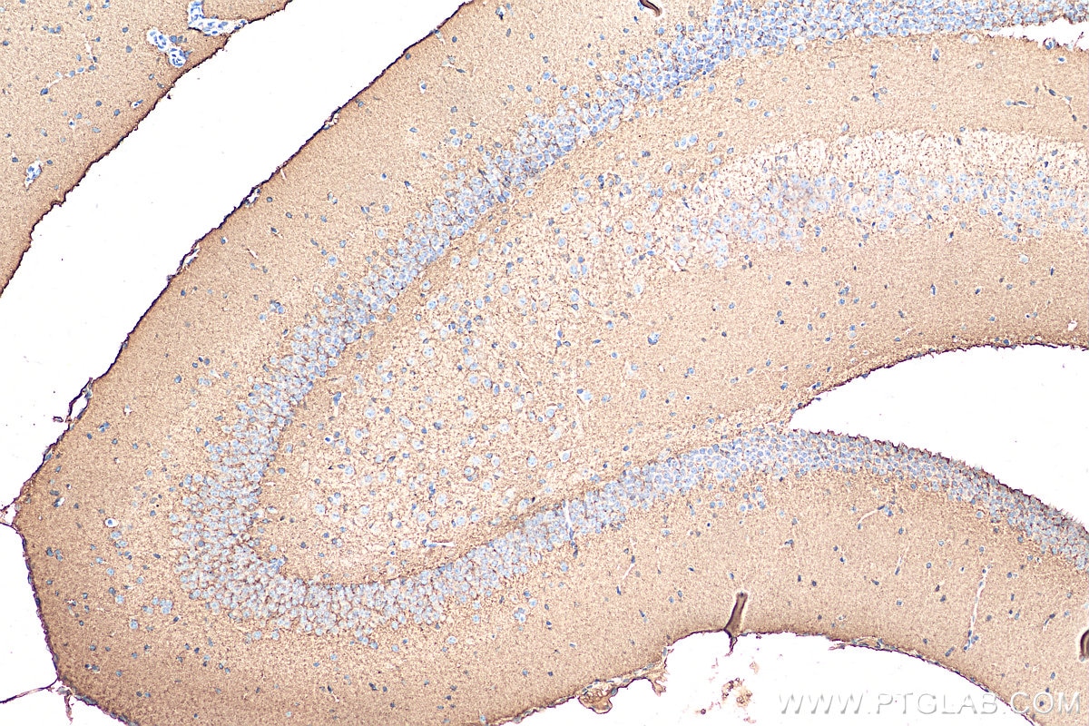 Immunohistochemistry (IHC) staining of mouse brain tissue using GAP43 Polyclonal antibody (16971-1-AP)