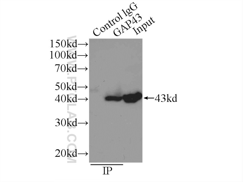 Immunoprecipitation (IP) experiment of mouse brain tissue using GAP43 Polyclonal antibody (16971-1-AP)