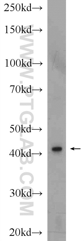 Western Blot (WB) analysis of rat lung tissue using GAP43 Polyclonal antibody (16971-1-AP)