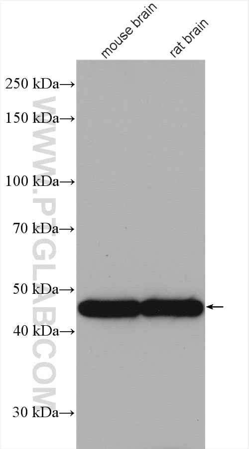 Western Blot (WB) analysis of various lysates using GAP43 Polyclonal antibody (16971-1-AP)