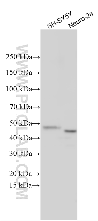 Western Blot (WB) analysis of various lysates using GAP43 Polyclonal antibody (16971-1-AP)