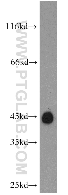 Western Blot (WB) analysis of mouse brain tissue using GAP43 Polyclonal antibody (16971-1-AP)