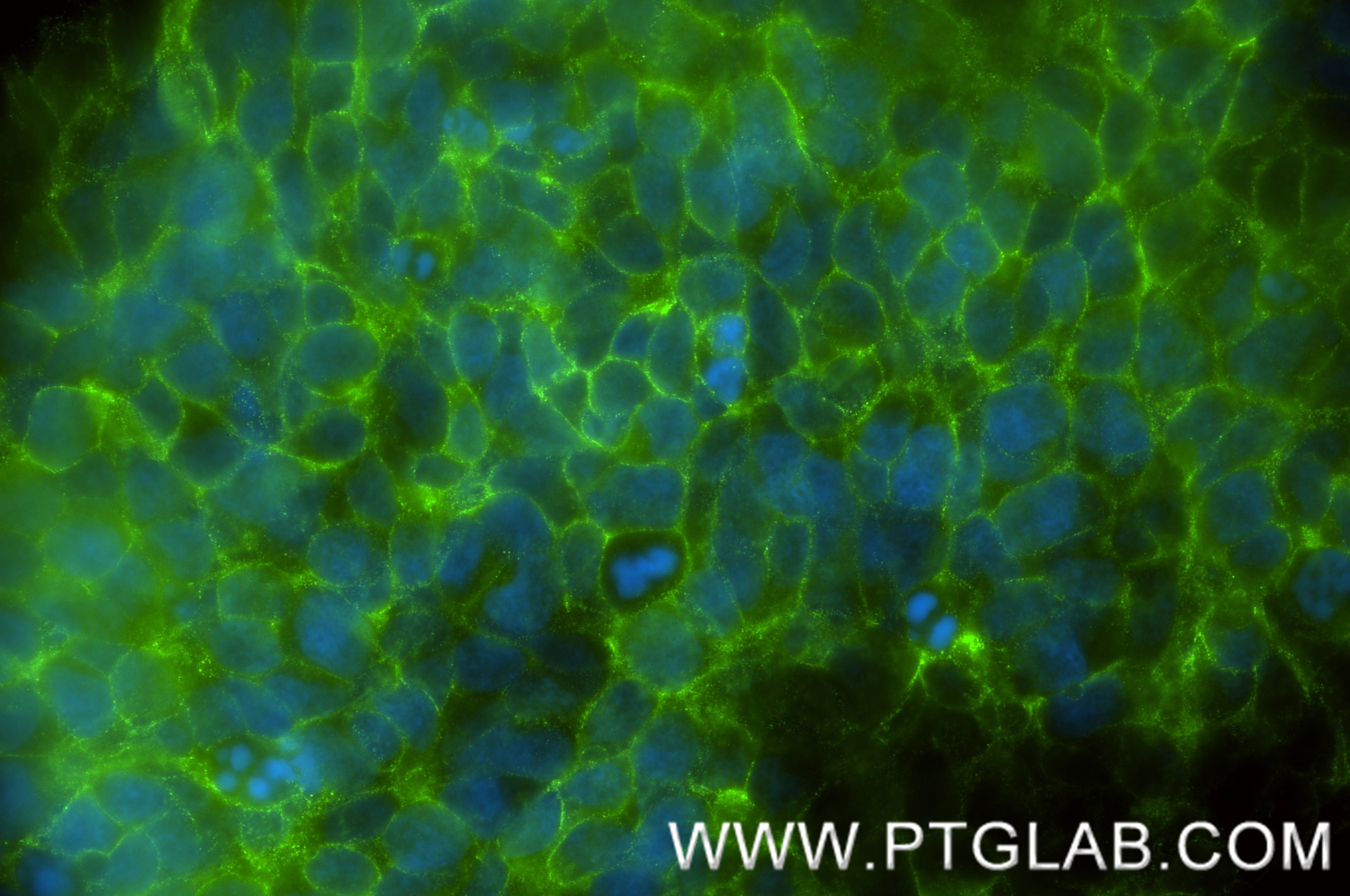 Immunofluorescent analysis of (4% PFA) fixed SH-SY5Y cells using GAP43 antibody (87287-1-RR, Clone: 252373G2 ) at dilution of 1:400 and CoraLite®488-Conjugated Goat Anti-Rabbit IgG(H+L) (SA00013-2). This data was developed using the same antibody clone with 87287-1-PBS in a different storage buffer formulation. Immunofluorescence (IF) / fluorescent staining of SH-SY5Y cells using GAP43 Recombinant monoclonal antibody (87287-1-RR)