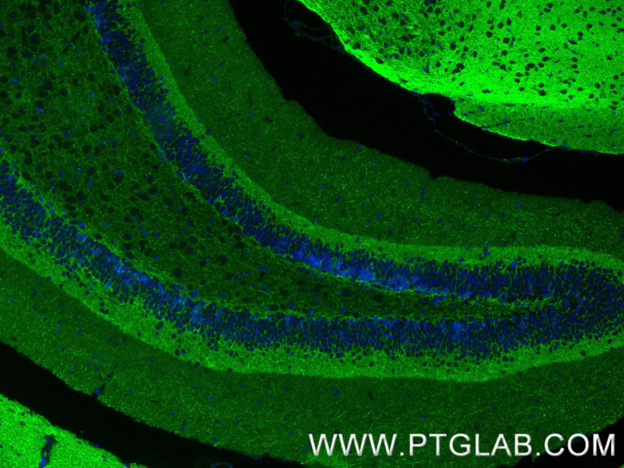 Immunofluorescent analysis of (4% PFA) fixed paraffin-embedded mouse brain tissue using GAP43 antibody (87287-1-RR, Clone: 252373G2 ) at dilution of 1:400 and CoraLite®488-Conjugated Goat Anti-Rabbit IgG(H+L) (SA00013-2). Heat mediated antigen retrieval with Tris-EDTA buffer (pH 9.0). This data was developed using the same antibody clone with 87287-1-PBS in a different storage buffer formulation. Immunofluorescence (IF) / fluorescent staining of mouse brain tissue using GAP43 Recombinant monoclonal antibody (87287-1-RR)