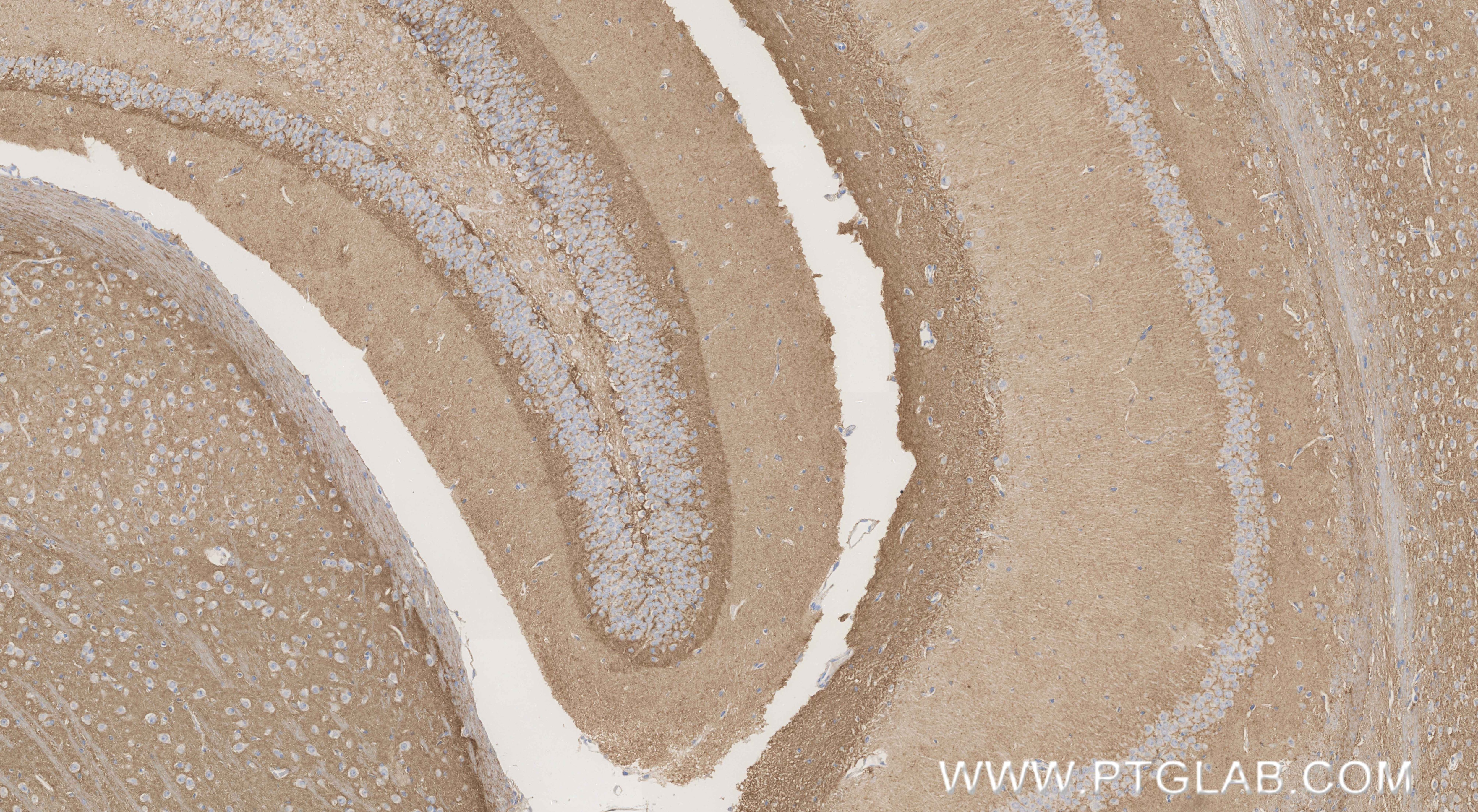 Immunohistochemical analysis of paraffin-embedded mouse brain tissue slide using 87287-1-RR (GAP43 antibody) at dilution of 1:1000 (under 10x lens). Heat mediated antigen retrieval with Tris-EDTA buffer (pH 9.0). This data was developed using the same antibody clone with 87287-1-PBS in a different storage buffer formulation. Immunohistochemistry (IHC) staining of mouse brain tissue using GAP43 Recombinant monoclonal antibody (87287-1-RR)