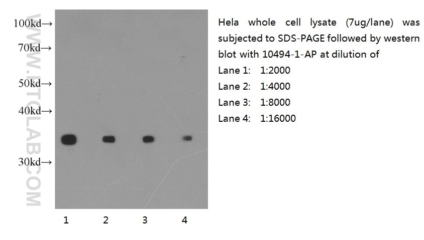 WB analysis of HeLa cells using 10494-1-AP