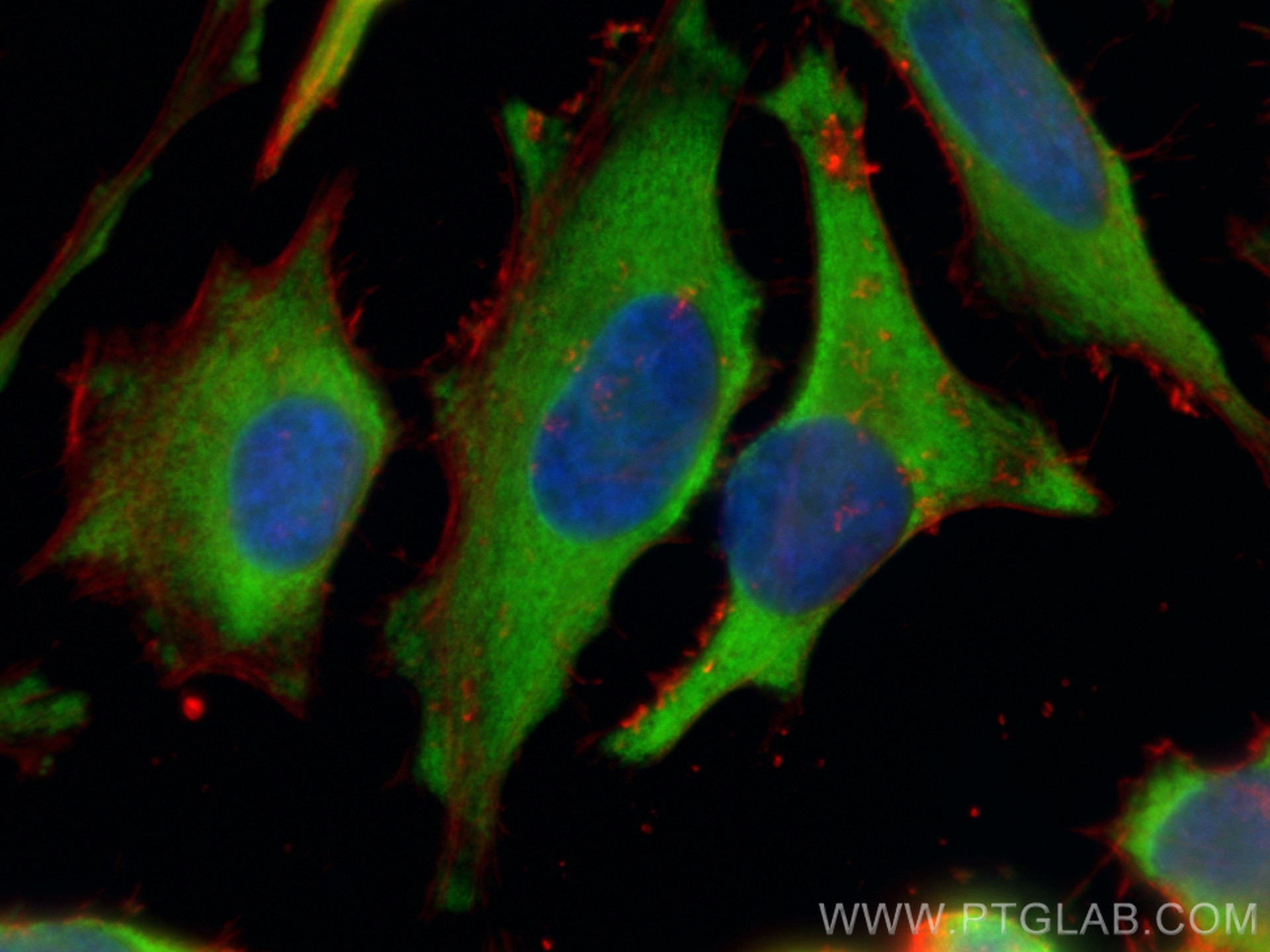 Immunofluorescence (IF) / fluorescent staining of HeLa cells using GAPDH Polyclonal antibody (10494-1-AP)