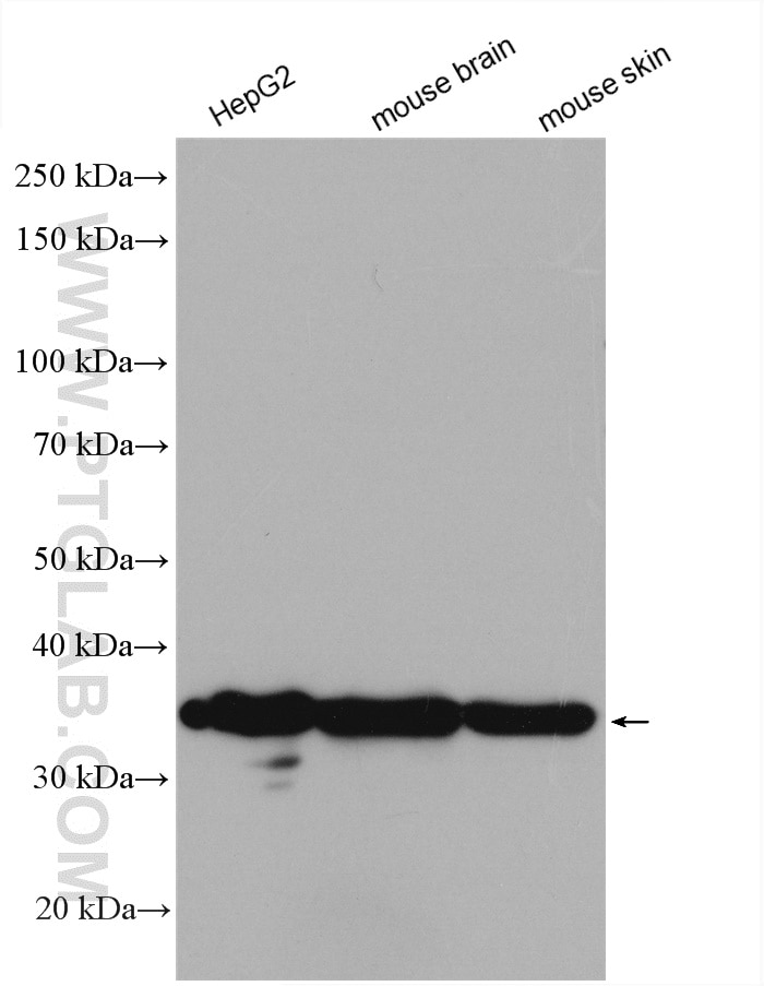 Western Blot (WB) analysis of various lysates using GAPDH Polyclonal antibody (10494-1-AP)