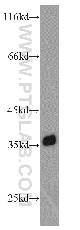 Western Blot (WB) analysis of Raji cells using GAPDH Polyclonal antibody (10494-1-AP)