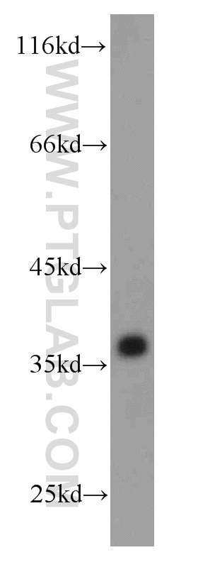 Western Blot (WB) analysis of K-562 cells using GAPDH Polyclonal antibody (10494-1-AP)