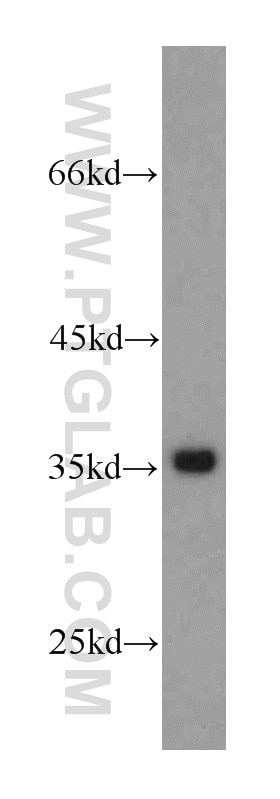 Western Blot (WB) analysis of mouse heart tissue using GAPDH Polyclonal antibody (10494-1-AP)