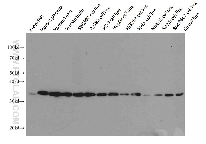 Western Blot (WB) analysis of HepG2 cells using GAPDH Monoclonal antibody (60004-1-Ig)