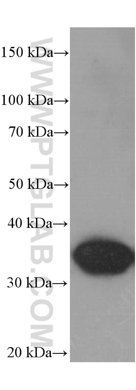 Western Blot (WB) analysis of whole Nematode tissue using GAPDH Monoclonal antibody (60004-1-Ig)