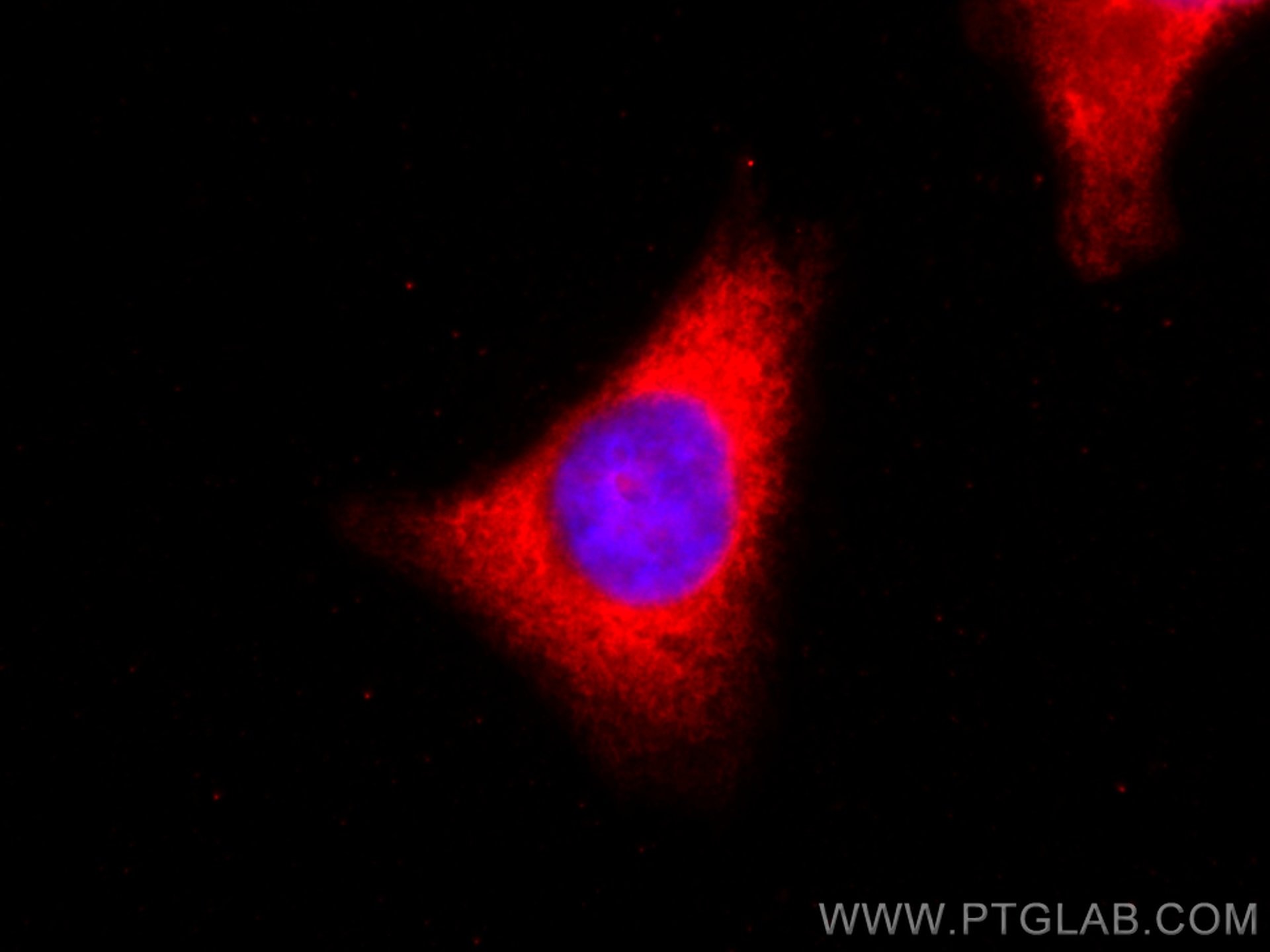 IF Staining of HeLa using 80570-1-RR