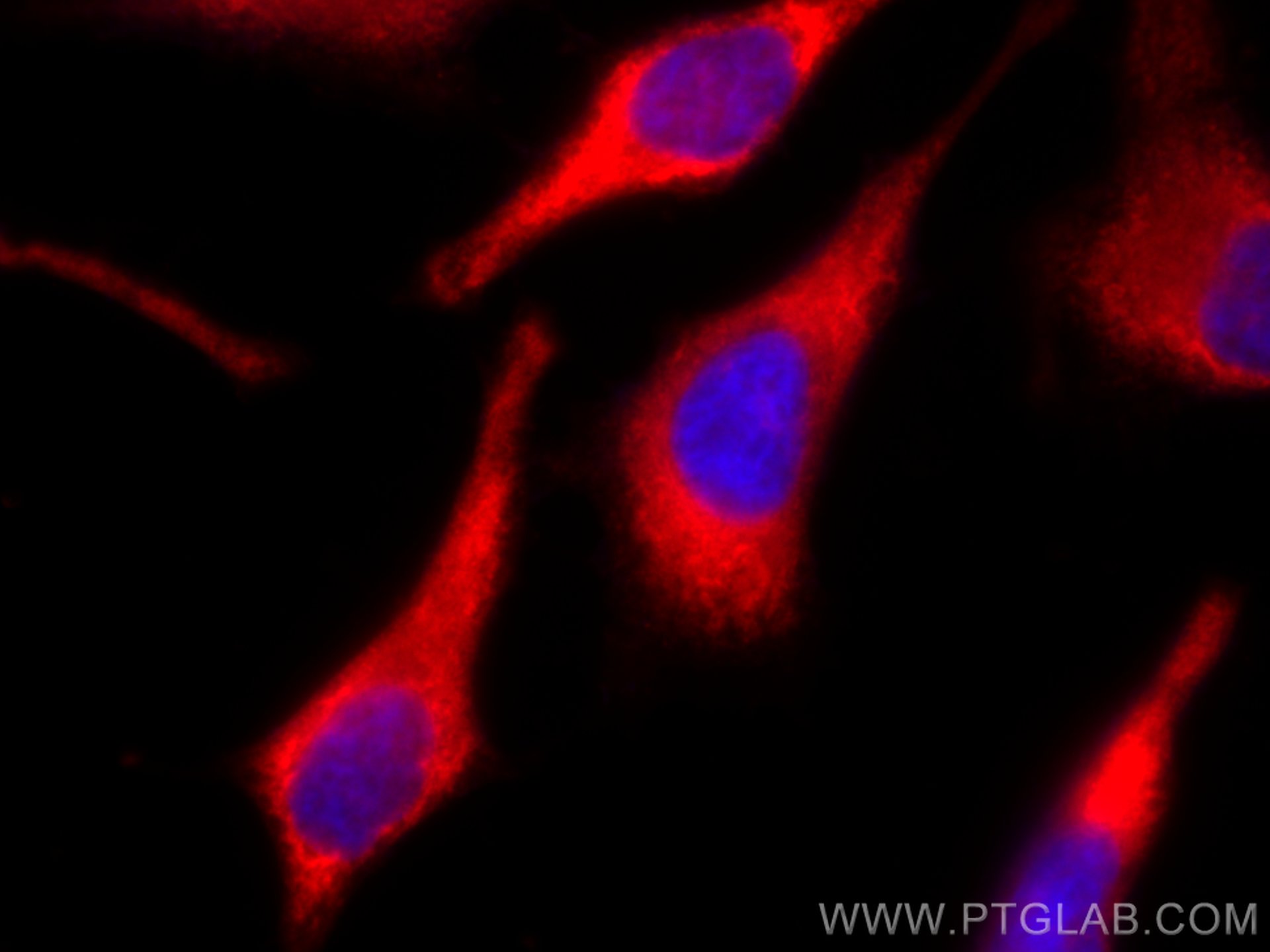 Immunofluorescence (IF) / fluorescent staining of HeLa cells using GAPDH (Human Specific) Recombinant antibody (80570-1-RR)