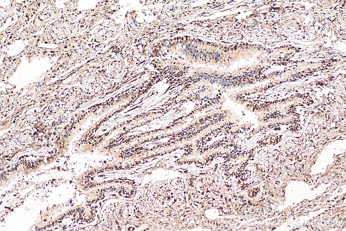 Immunohistochemistry (IHC) staining of human lung tissue using GAPDH (Human Specific) Recombinant antibody (80570-1-RR)