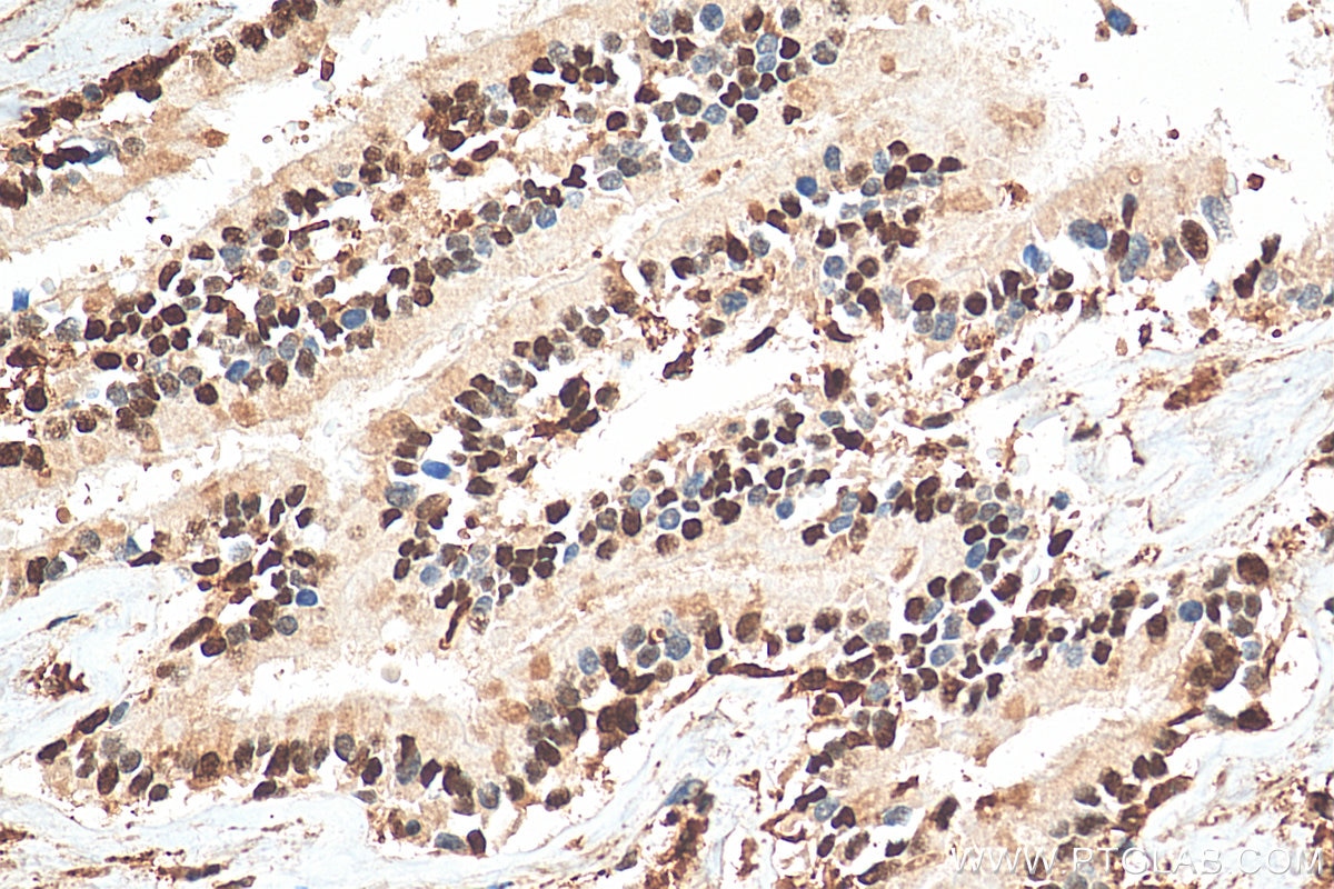 Immunohistochemistry (IHC) staining of human lung tissue using GAPDH (Human Specific) Recombinant antibody (80570-1-RR)