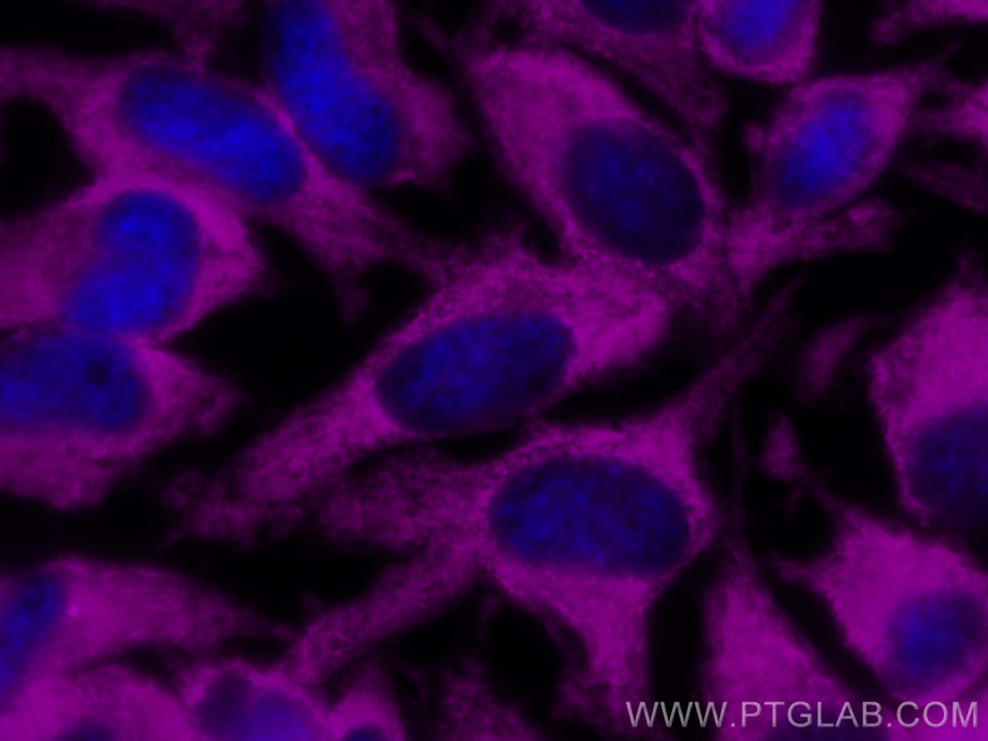 IF Staining of HeLa using CL647-60004