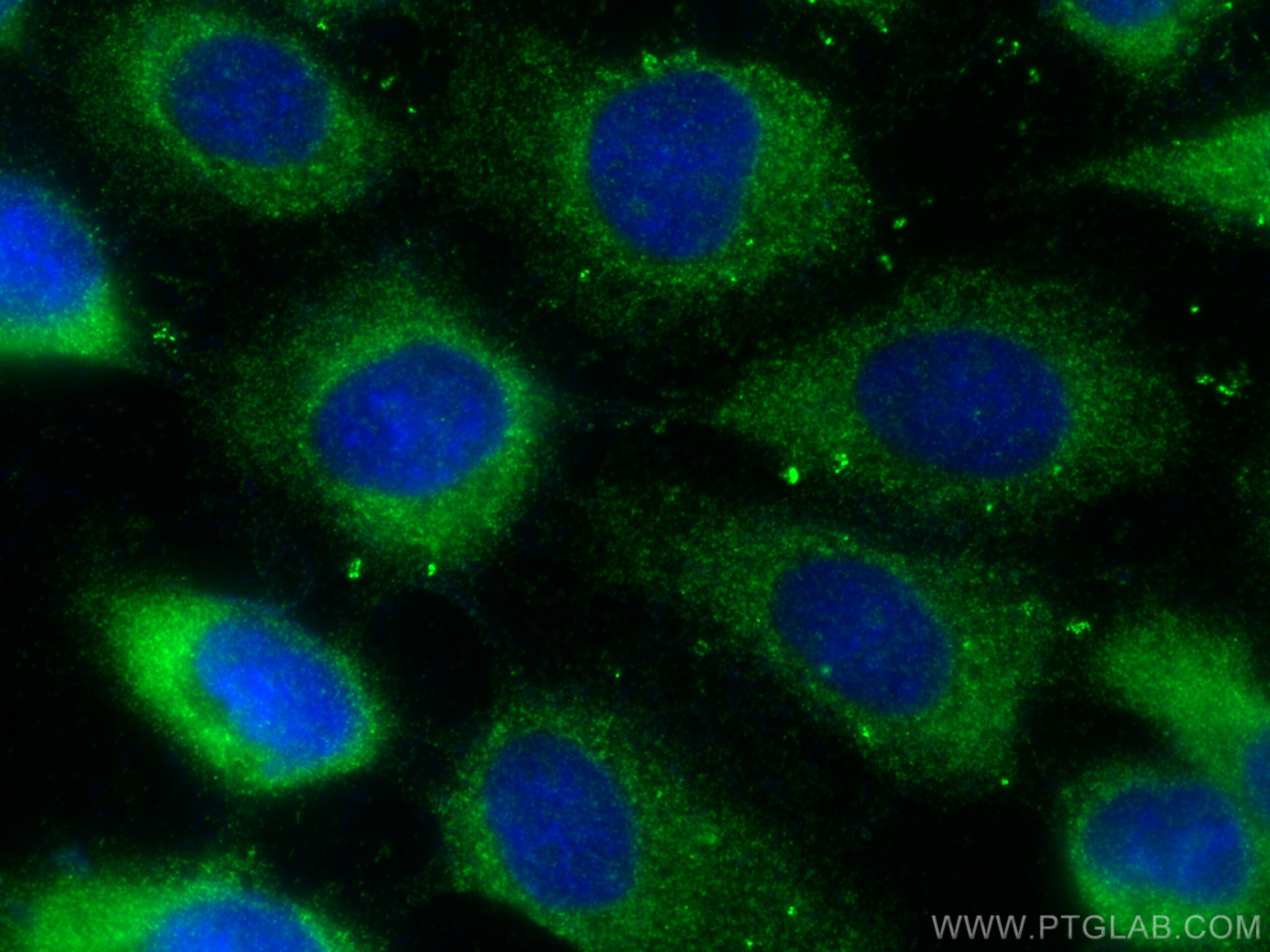 Immunofluorescence (IF) / fluorescent staining of A431 cells using GAPVD1 Polyclonal antibody (16940-1-AP)