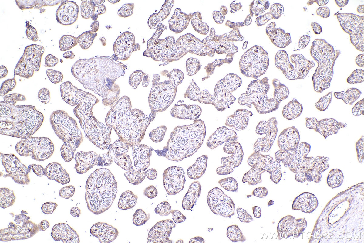 Immunohistochemistry (IHC) staining of human placenta tissue using GAPVD1 Polyclonal antibody (16940-1-AP)