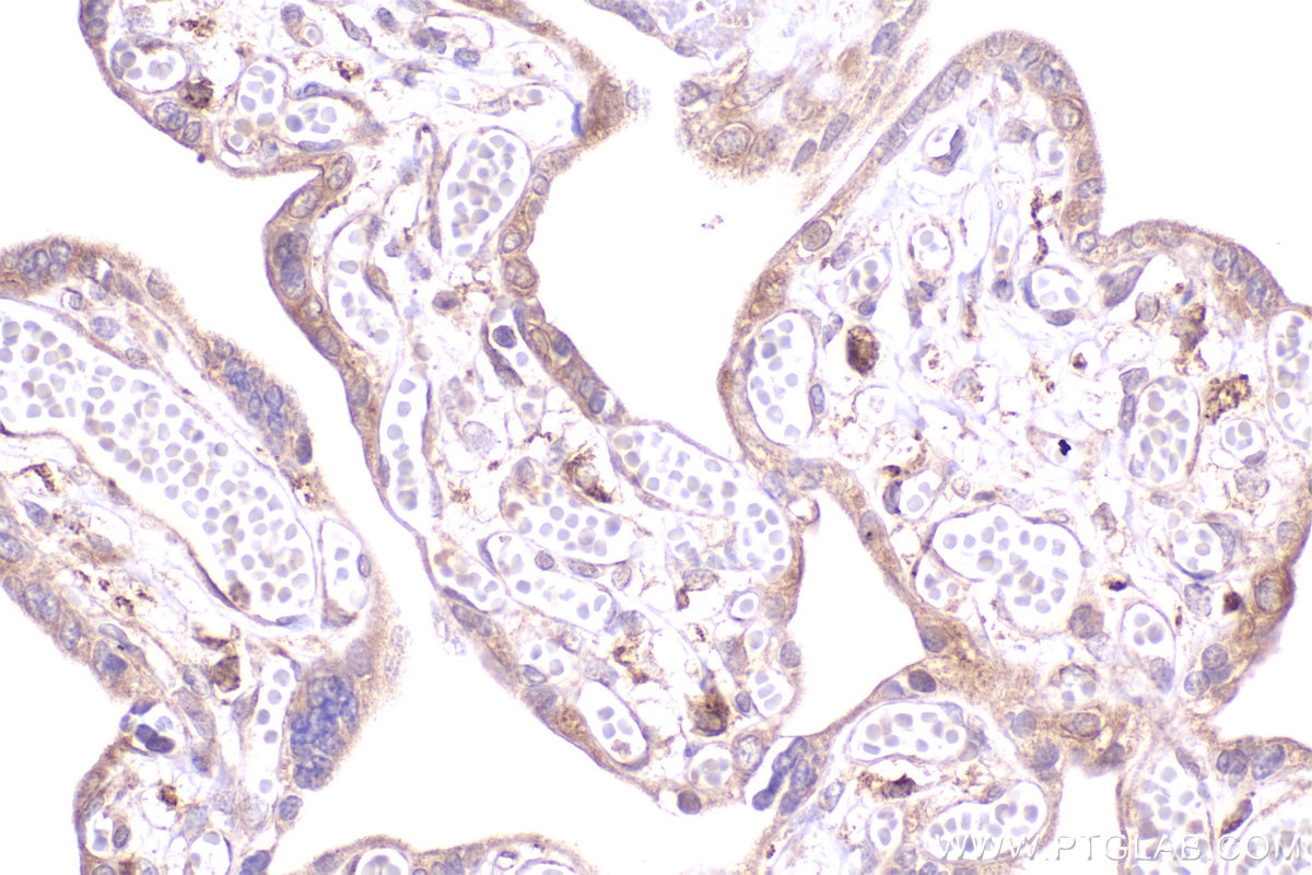 Immunohistochemistry (IHC) staining of human placenta tissue using GAPVD1 Polyclonal antibody (16940-1-AP)