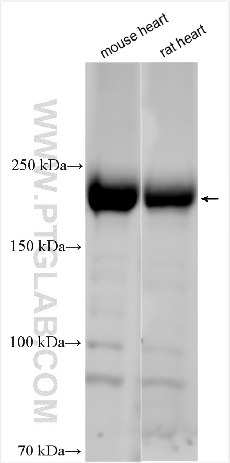 Western Blot (WB) analysis of various lysates using GAPVD1 Polyclonal antibody (16940-1-AP)
