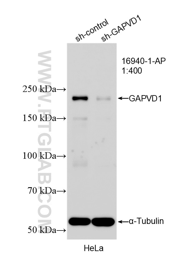 WB analysis of HeLa using 16940-1-AP Western Blot (WB) analysis of HeLa cells using GAPVD1 Polyclonal antibody (16940-1-AP)