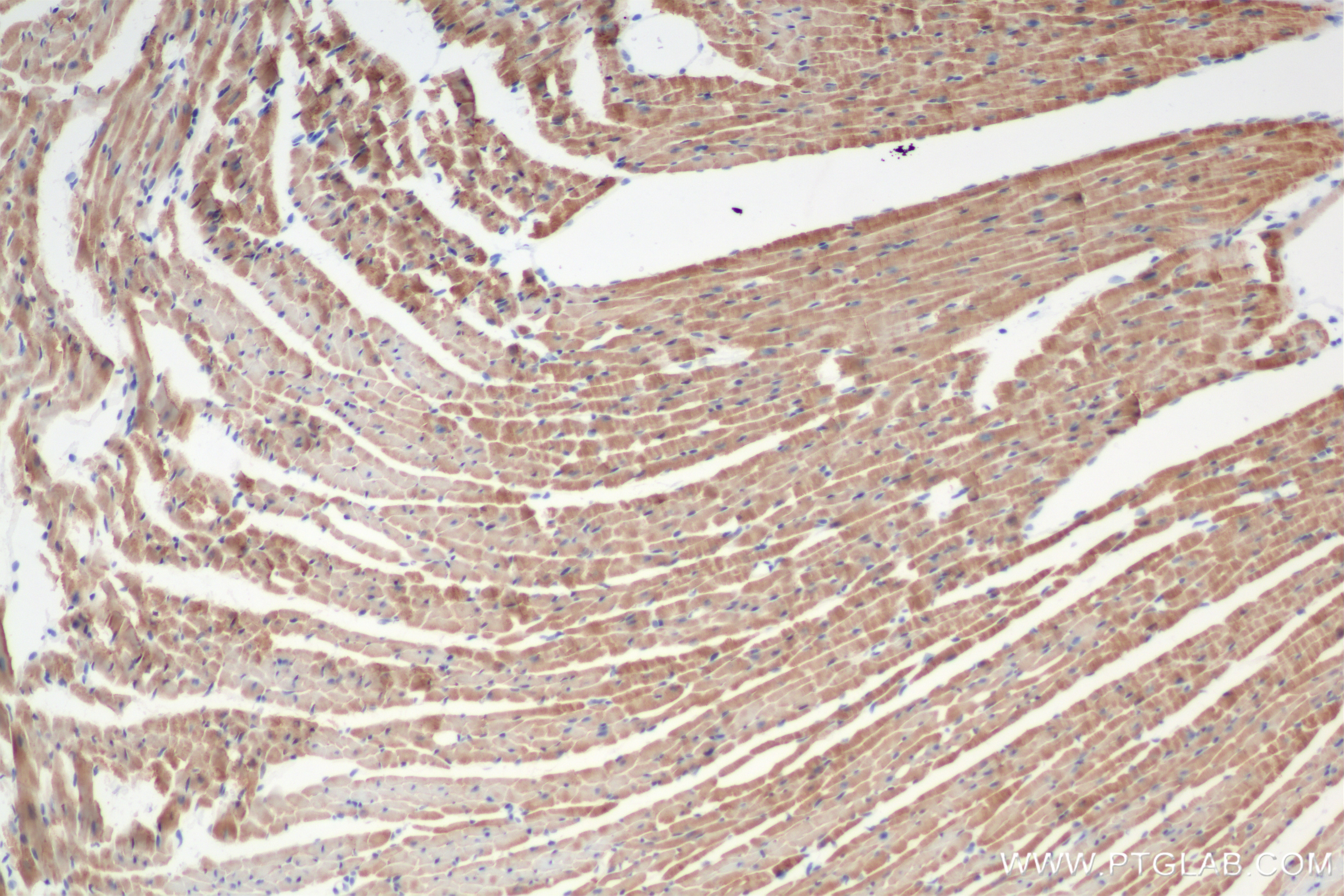 Immunohistochemistry (IHC) staining of mouse heart tissue using GAPVD1 Recombinant antibody (84343-3-RR)
