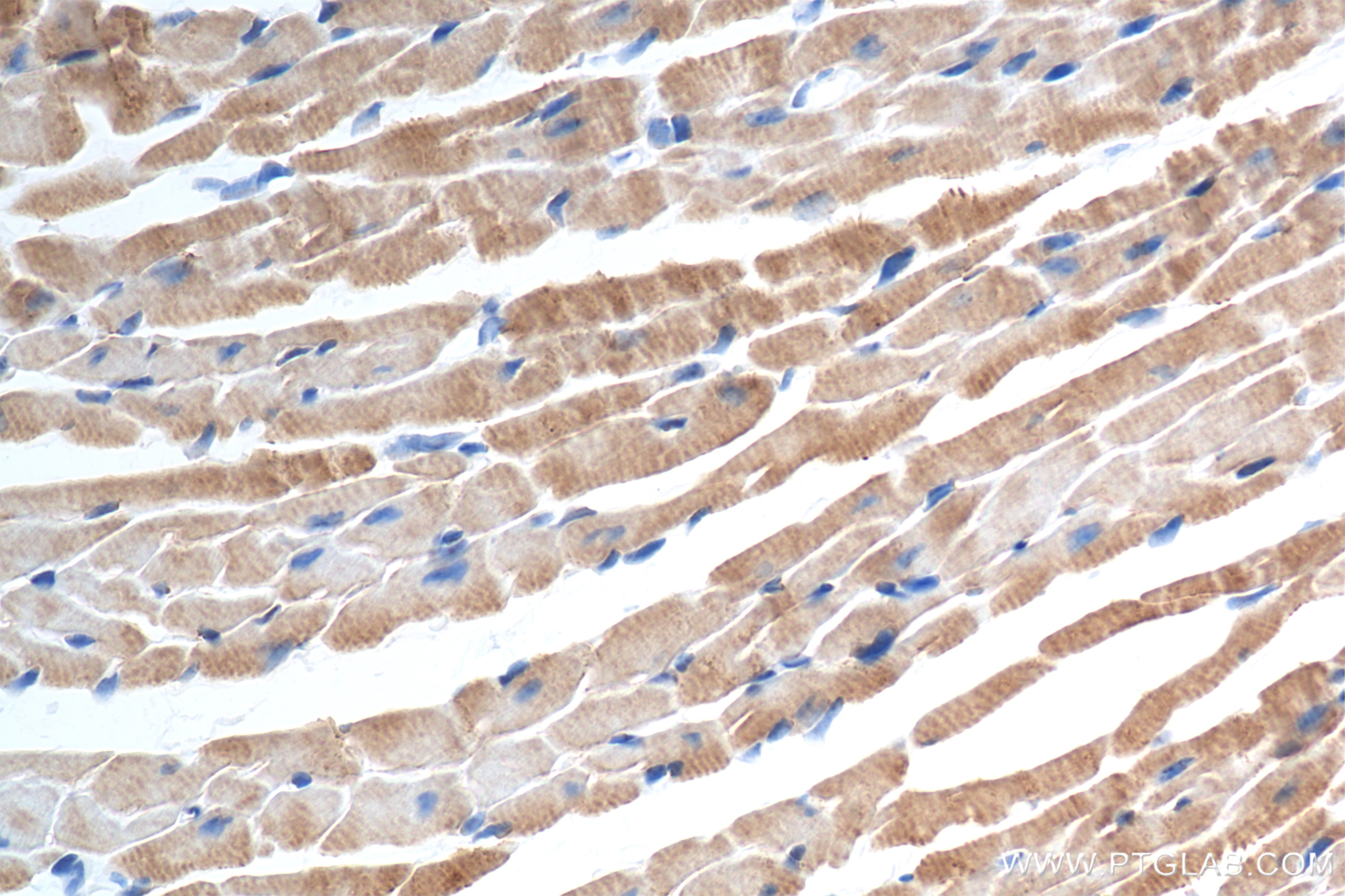 Immunohistochemistry (IHC) staining of mouse heart tissue using GAPVD1 Recombinant antibody (84343-3-RR)