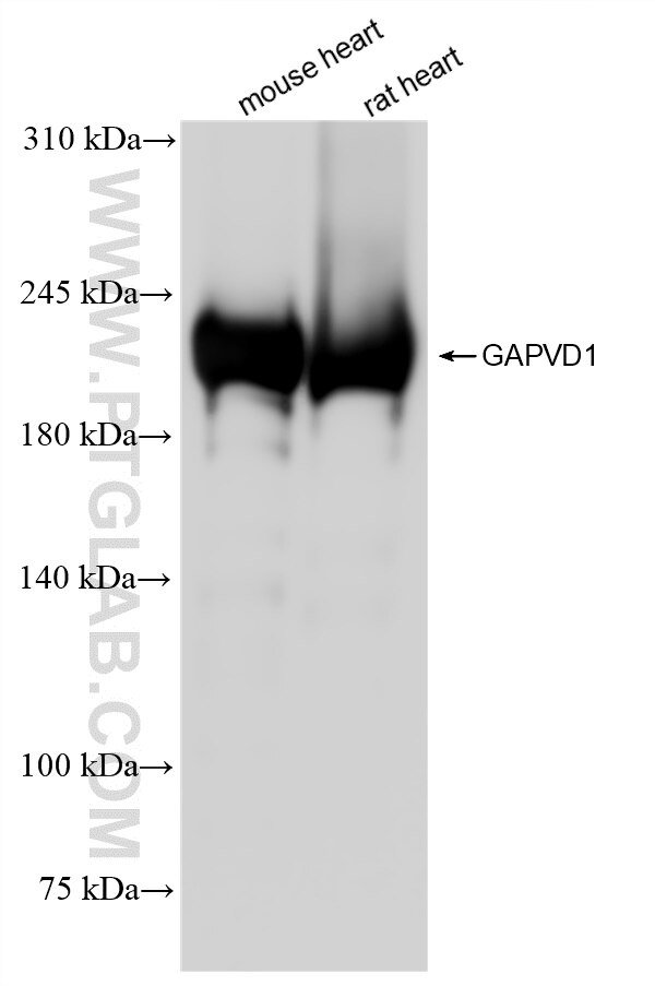 Western Blot (WB) analysis of various lysates using GAPVD1 Recombinant antibody (84343-3-RR)
