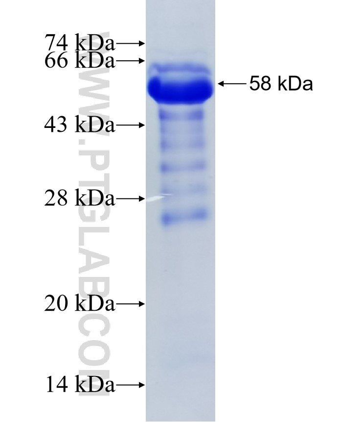 GAPVD1 fusion protein Ag10492 SDS-PAGE