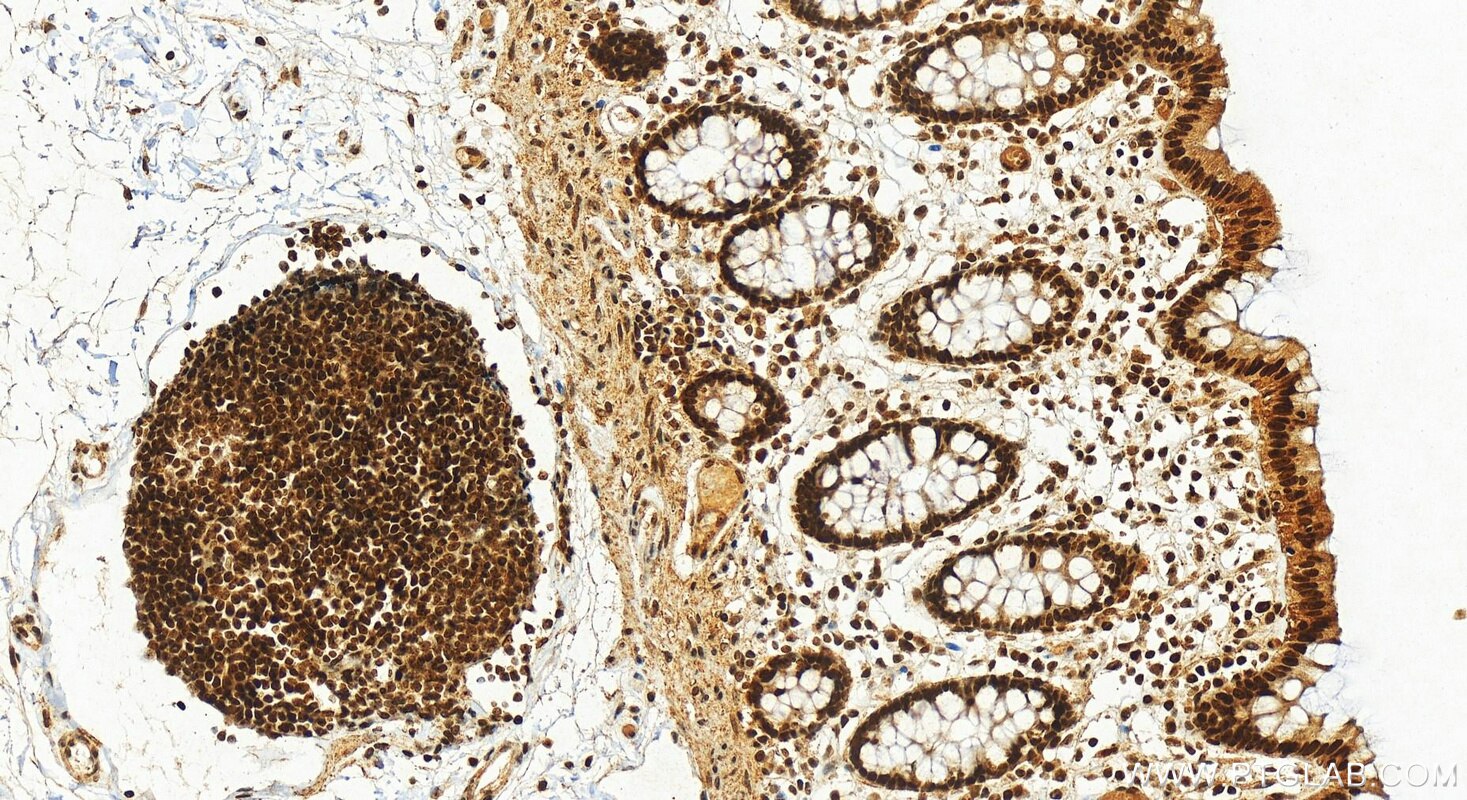 Immunohistochemistry (IHC) staining of human colon tissue using GAR1 Polyclonal antibody (11711-1-AP)