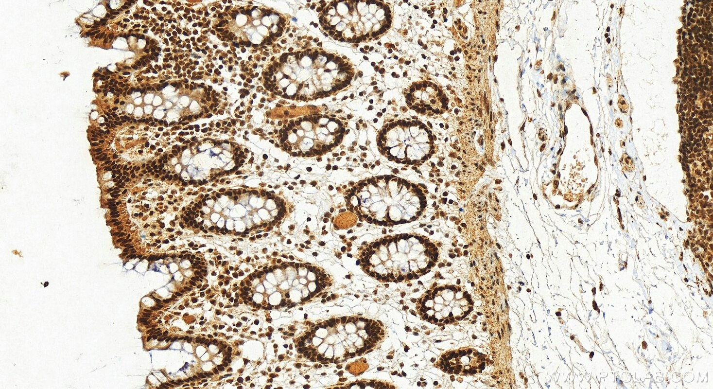 Immunohistochemistry (IHC) staining of human colon tissue using GAR1 Polyclonal antibody (11711-1-AP)