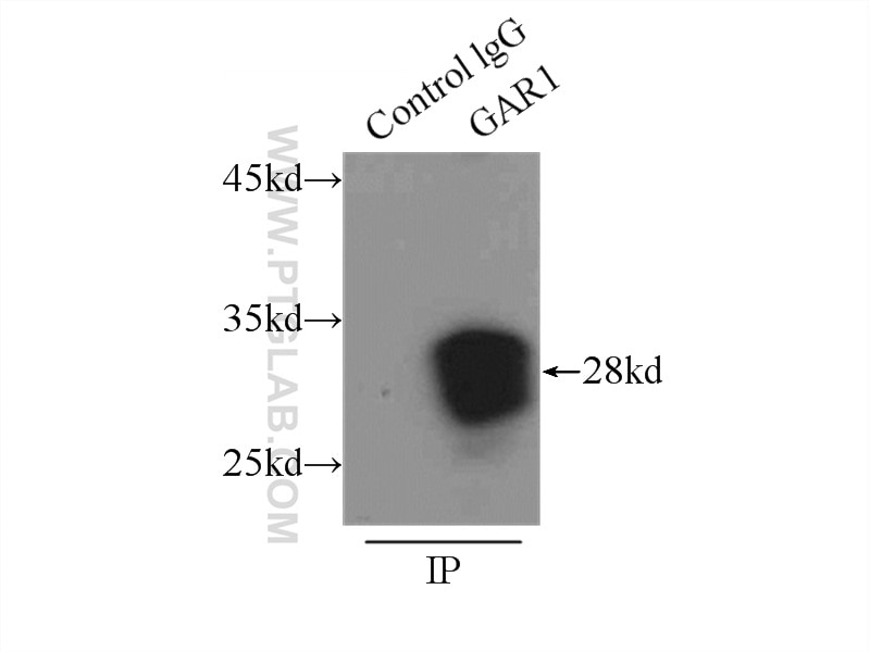 Immunoprecipitation (IP) experiment of A375 cells using GAR1 Polyclonal antibody (11711-1-AP)