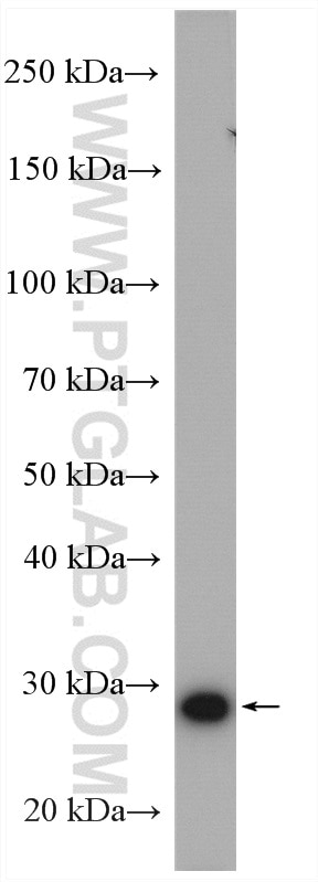 Western Blot (WB) analysis of HeLa cells using GAR1 Polyclonal antibody (11711-1-AP)