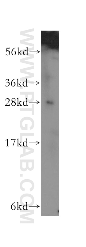 Western Blot (WB) analysis of human skin tissue using GAR1 Polyclonal antibody (11711-1-AP)