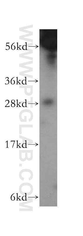 Western Blot (WB) analysis of A375 cells using GAR1 Polyclonal antibody (11711-1-AP)