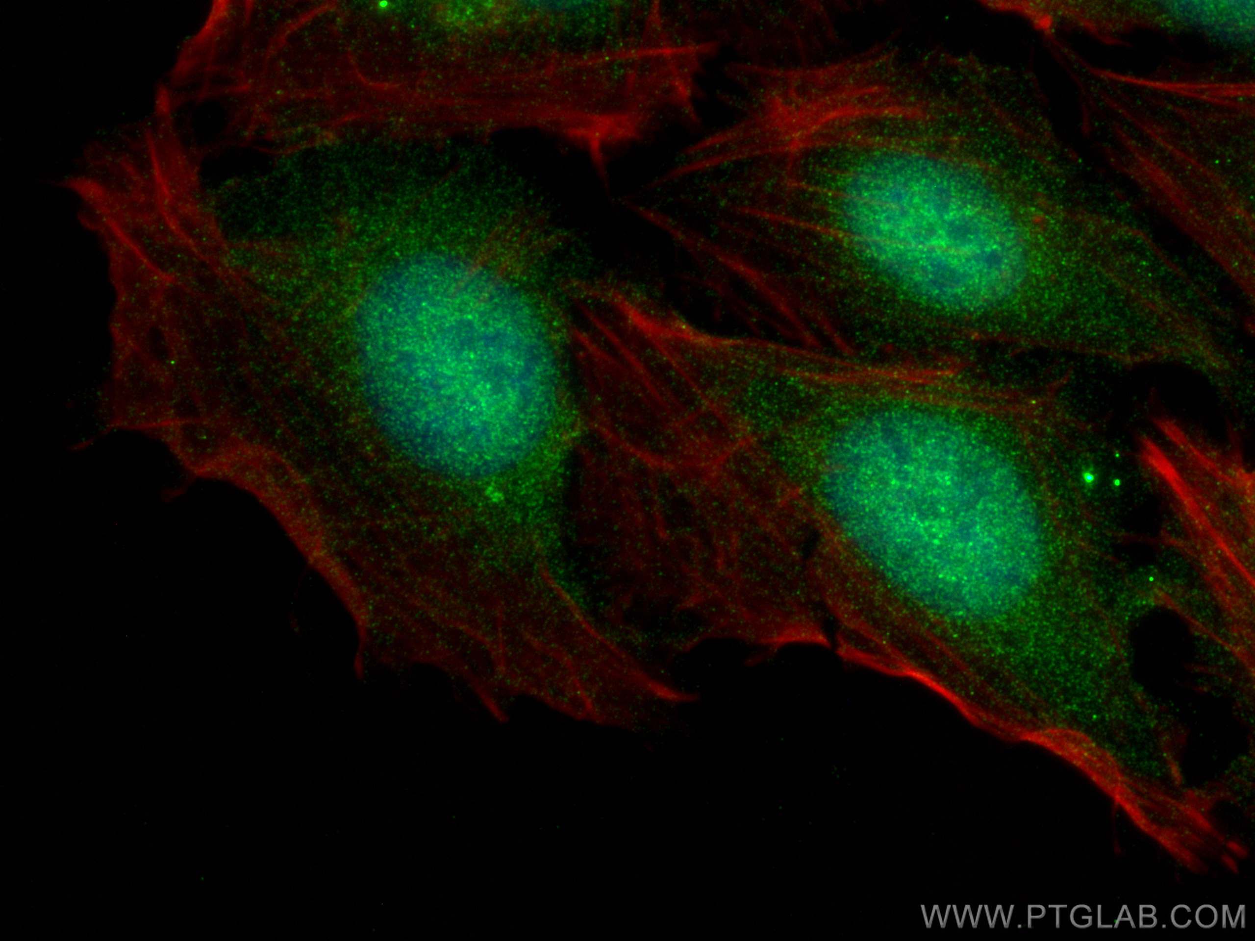Immunofluorescence (IF) / fluorescent staining of U2OS cells using GARNL1 Polyclonal antibody (29847-1-AP)