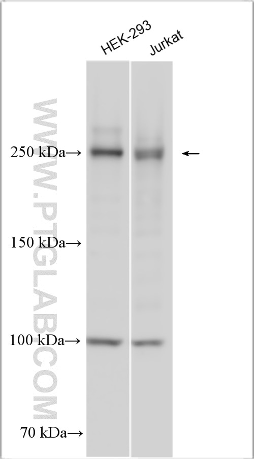 Western Blot (WB) analysis of various lysates using GARNL1 Polyclonal antibody (29847-1-AP)